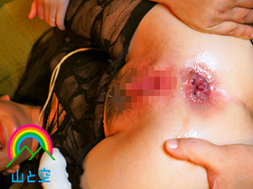 ＯＬアナル調教 ２穴開発されてしまい肛門奴隷と化したＯＬ １２時間　サンプル画像18